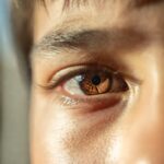 Kedutan Kelopak Mata Kanan Bawah Makna dan Penyebabnya